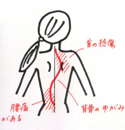 腰痛　ヨガ解剖学
