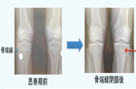 ヨガ解剖学　子供　骨盤